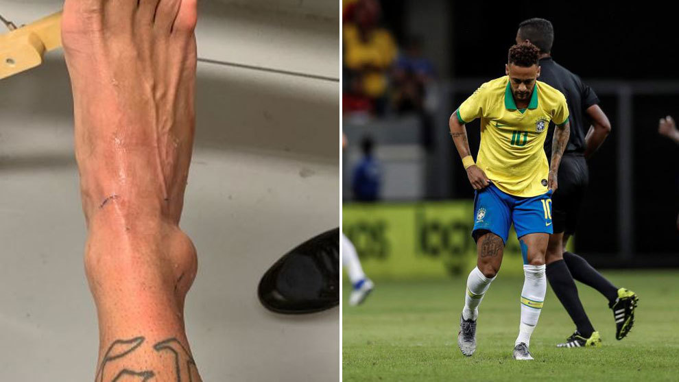 Neymar Reveals He Was Afraid He Would Miss Remainder of FIFA World Cup 2022 After Sustaining Injury
